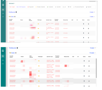 "Dynamic digital pull" system. My sub-specialities GI and H&N have separate pull lists. Clicking the hand icon brings the case into my ready to report list. If unreported or extra work not requested in a few hours the cases are returned to pull.