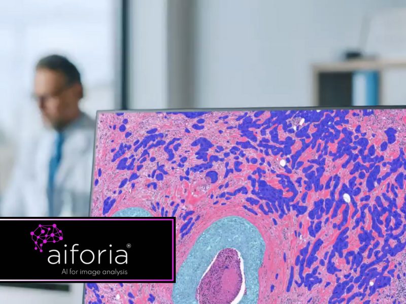 Aiforia CE-IVD-marked clinical AI solution for breast cancer diagnostics