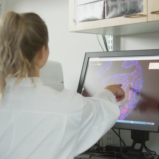 aiforia digital pathology showcase ecdp 2025