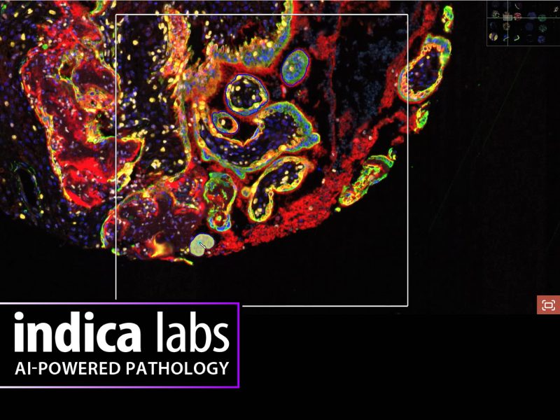 Indica labs Halo AI Digital Pathology