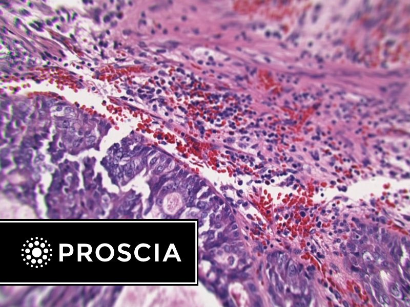 Proscia Digital Pathology Majority of diagnostic laboratory leaders bet big on digital pathology and ai
