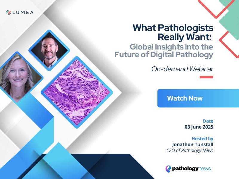 What Pathologists Really Want: Global Insights into the Future of Digital Pathology. A Lumea, Path News Webinar.