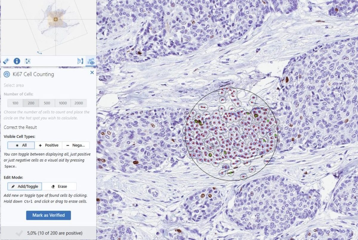 PAthology KI67 Cellcounting Image window
