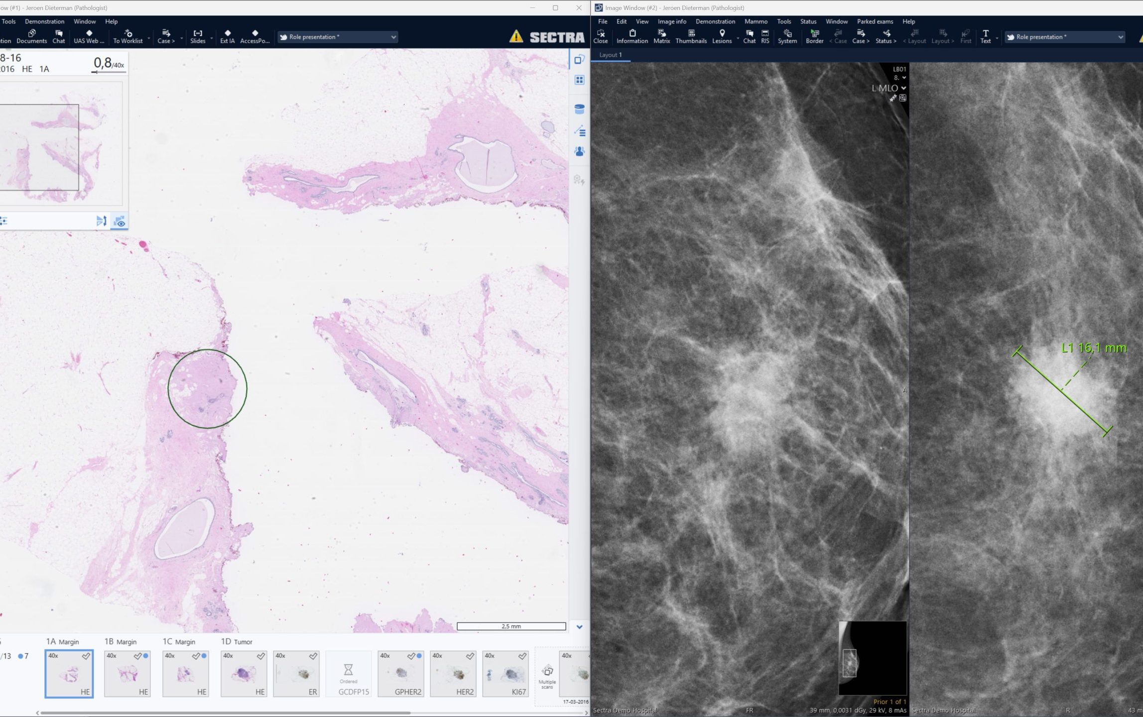 Pathology Rad Path Image window3