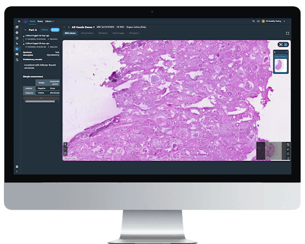 Techcyte ui in monitor frozen section Digital Pathology