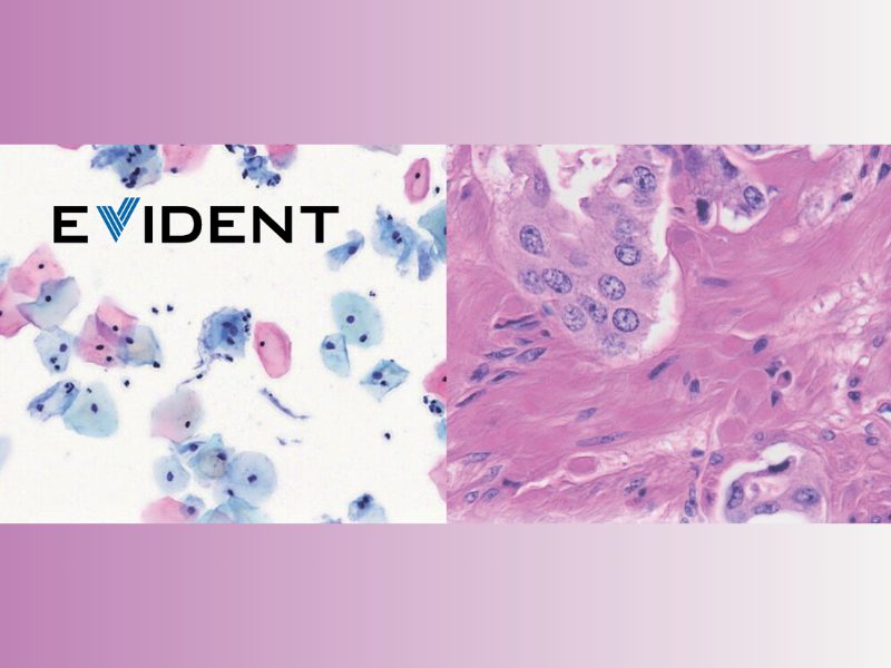 Evident scientific ecdp 2025 digital pathology