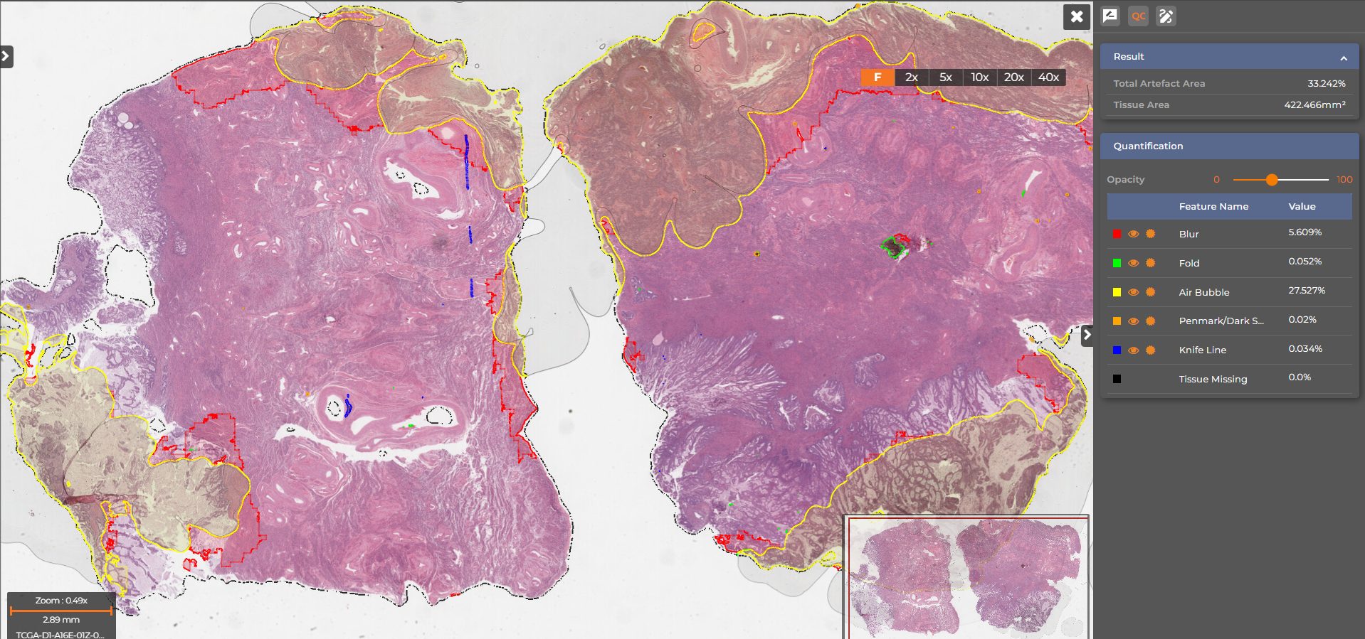 AIRA Matrix Digital Pathology Image Quality Control
