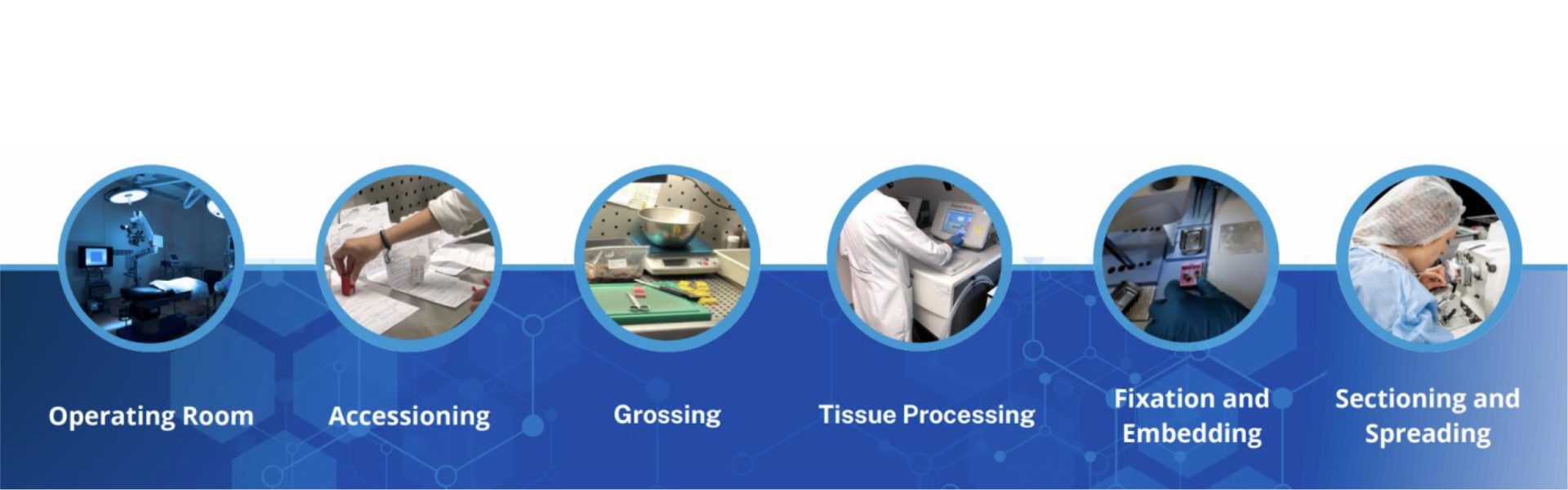 AI-Powered Solution Algoscope