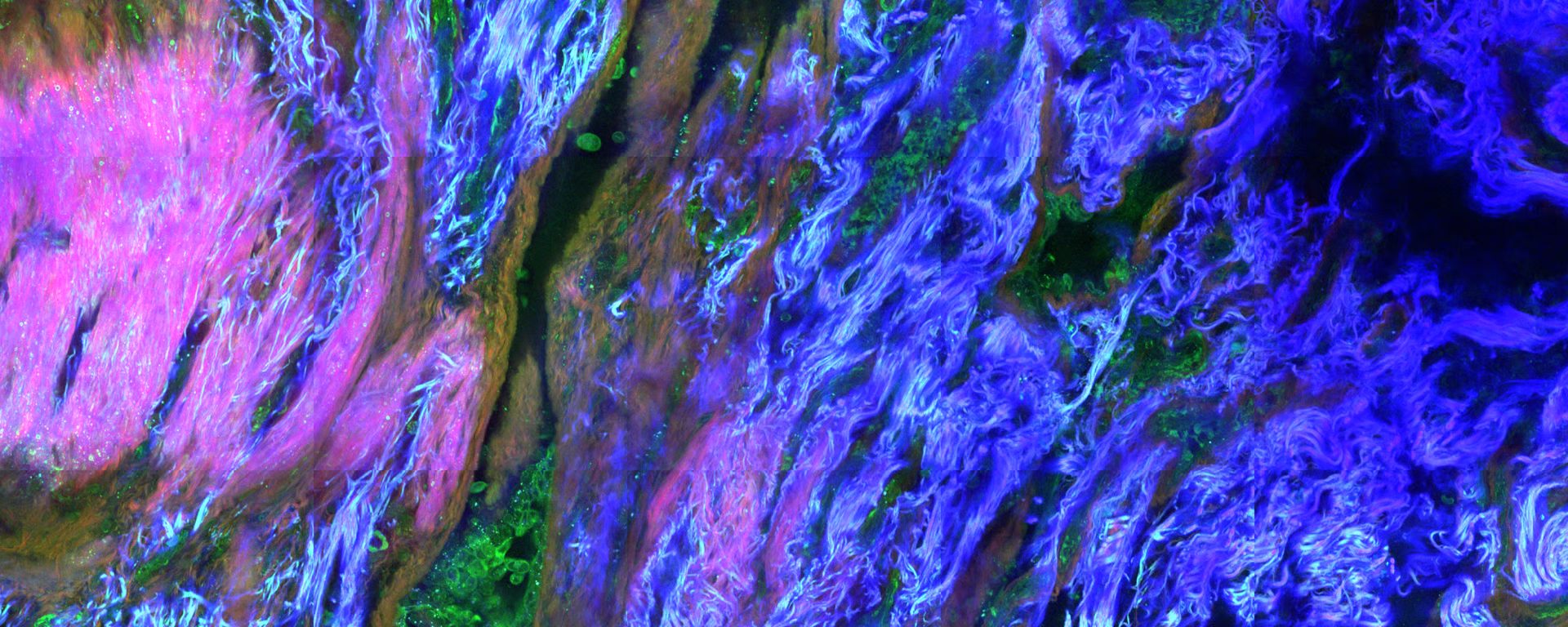 Tissue