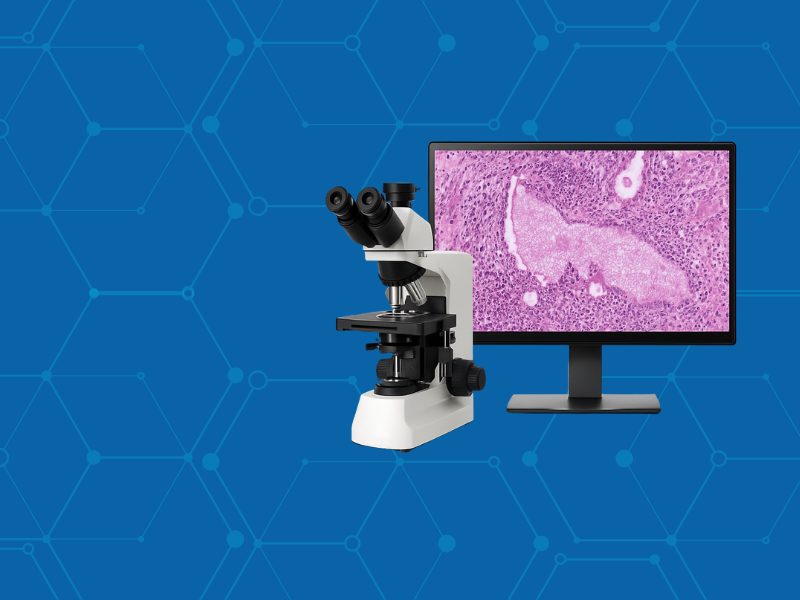 Democratizing Cancer Diagnostics: Low-Cost Digital Pathology Rivals High-End Systems