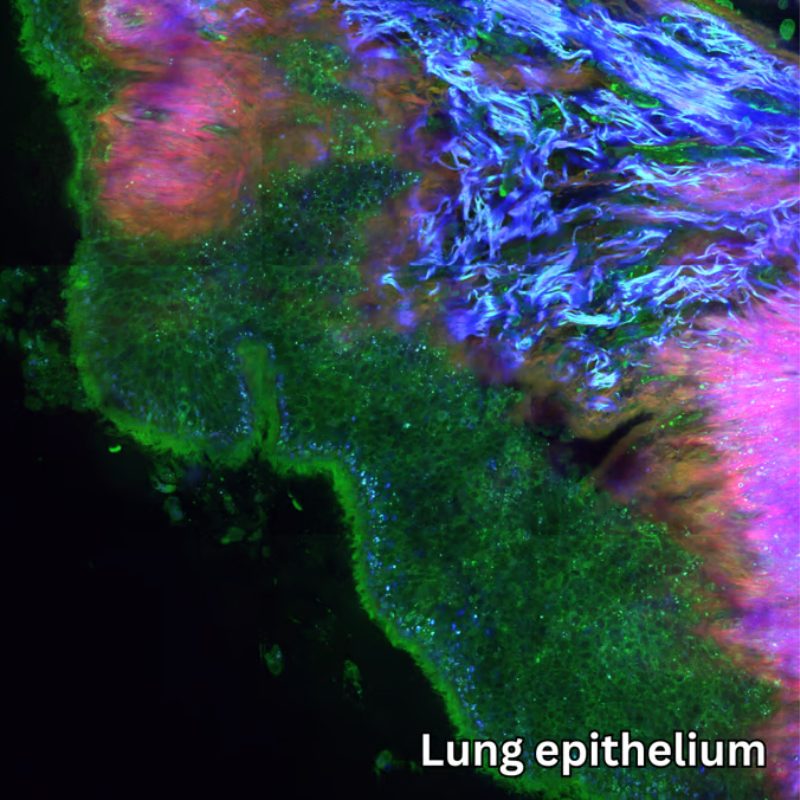 Lung Epithelium