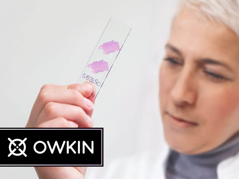 Can an AI diagnostic help doctors make more precise treatment decisions for breast cancer?