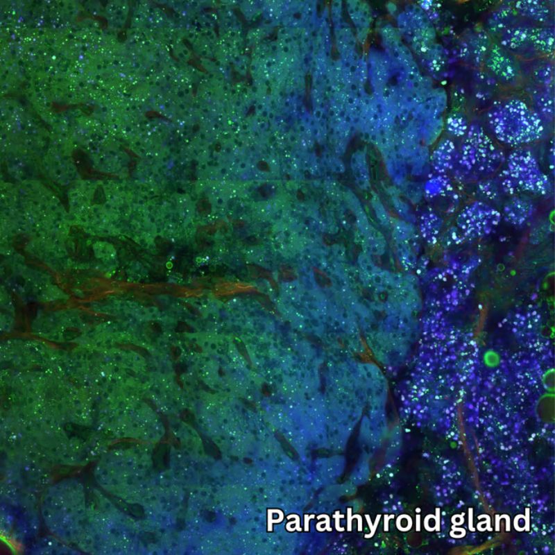 Parathyroid Gland