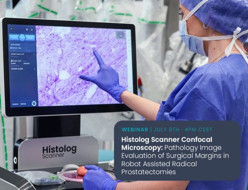 Histolog Scanner Confocal Microscopy: Pathology Image Evaluation of Surgical Margins in Robot Assisted Radical Prostatectomies