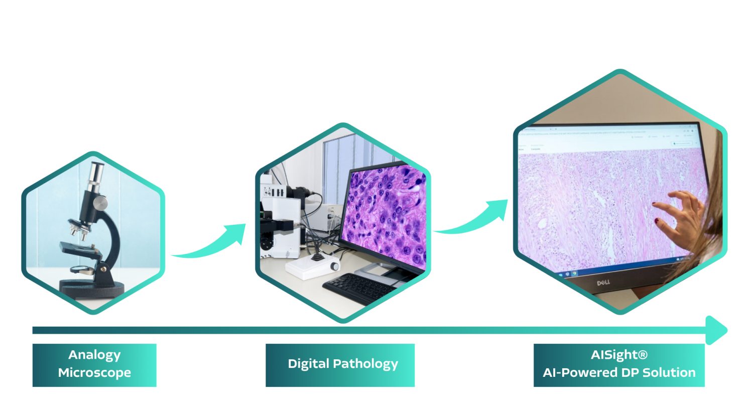 From manual to AI-empowered digital pathology