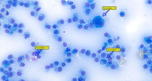 Nationawide Laboratories cytological image