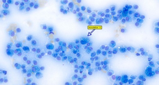 Nationawide Laboratories cytological image