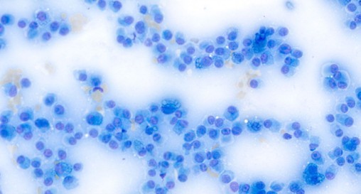 Nationawide Laboratories cytological image