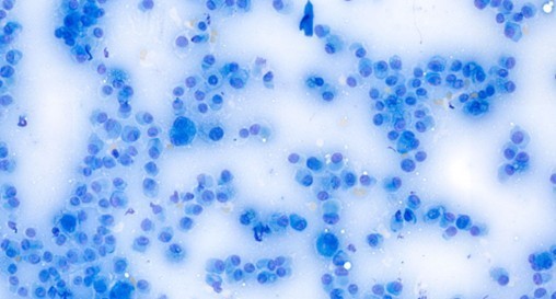 Nationawide Laboratories cytological image