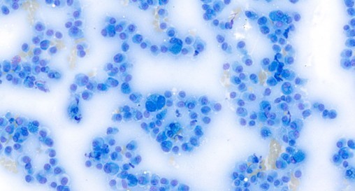 Nationawide Laboratories cytological image