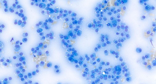 Nationawide Laboratories cytological image