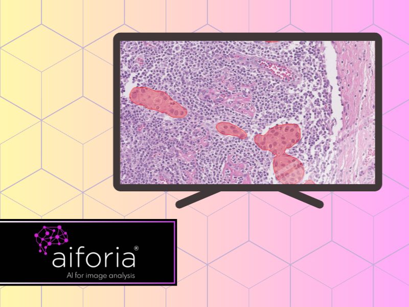 Aiforia releases a new ce ivd marked clinical ai solution for lymph node metastasis detection