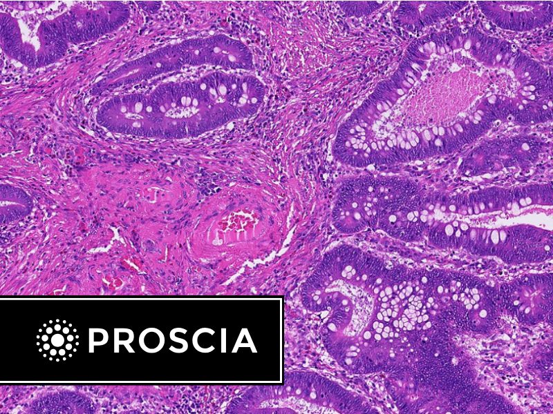 Digital pathology as a business imperative lessons from hnl lab medicine’s coo
