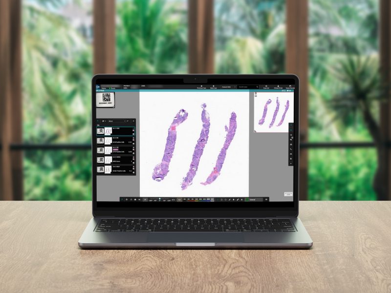 Digital pathology in clinical trials driving faster drug development