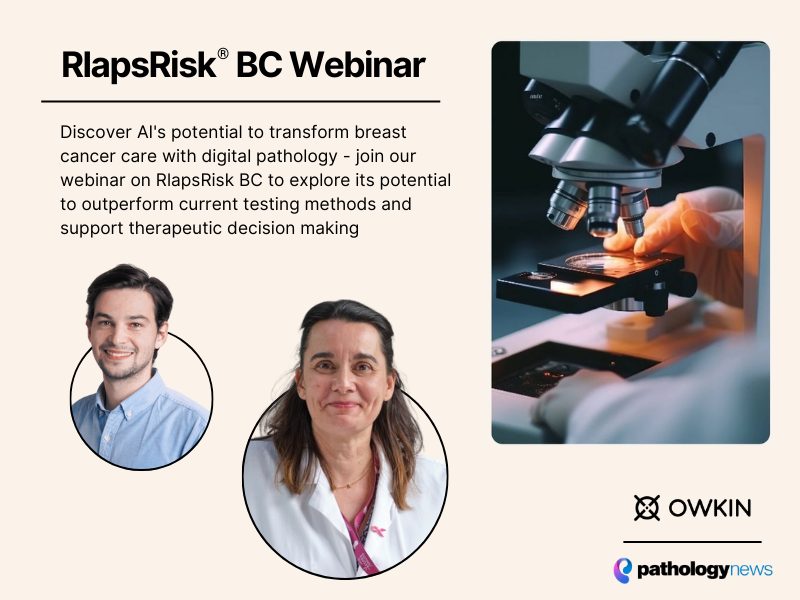 Featured image breast cancer recurrence risk assessment from digitized h&e with rlapsrisk bc, a clinic (1)