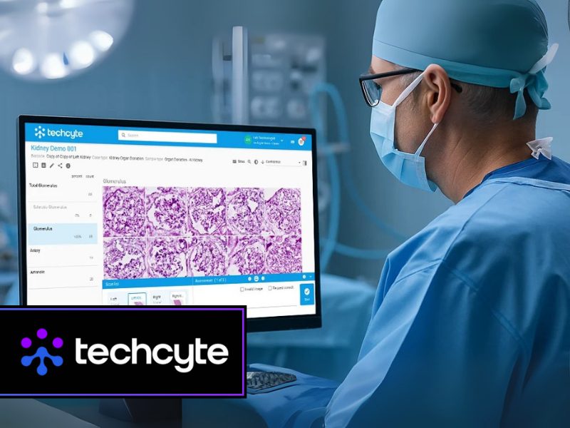 Study validates techcyte fusion™ ai assisted kidney biopsy evaluation to improve organ allocation efficiency