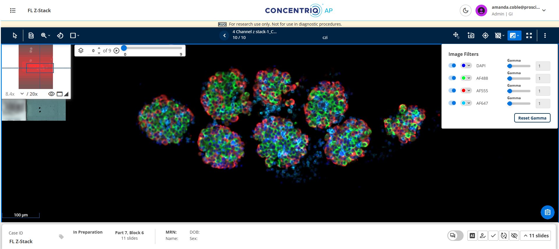Fluorescent Z-stack image support