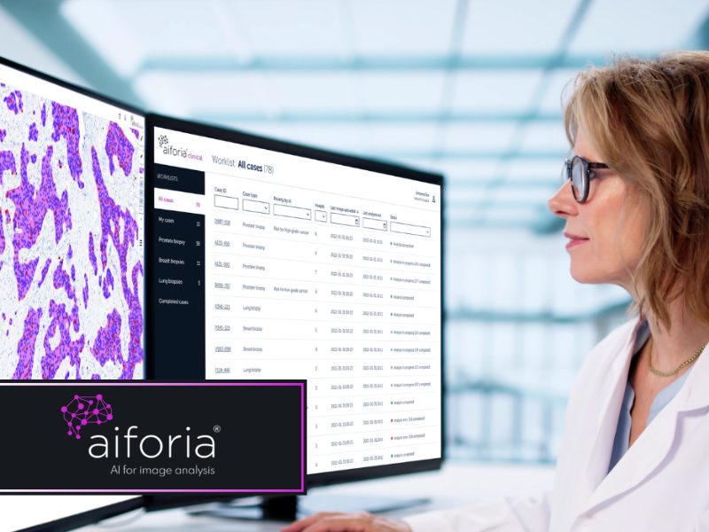 Aiforia’s ai solutions for breast cancer diagnostics implemented at fimlab laboratories