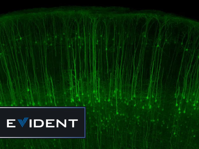 Evident’s new fluoview™ fv5000 redefines the boundaries of confocal and multiphoton imaging