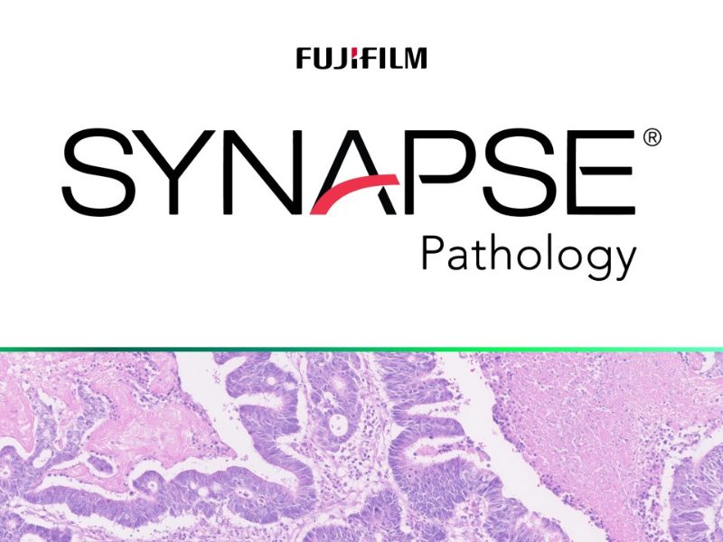 Fujifilm healthcare uk and one dorset pathology agree mes for digital pathology to support nhs pathology across dorset.
