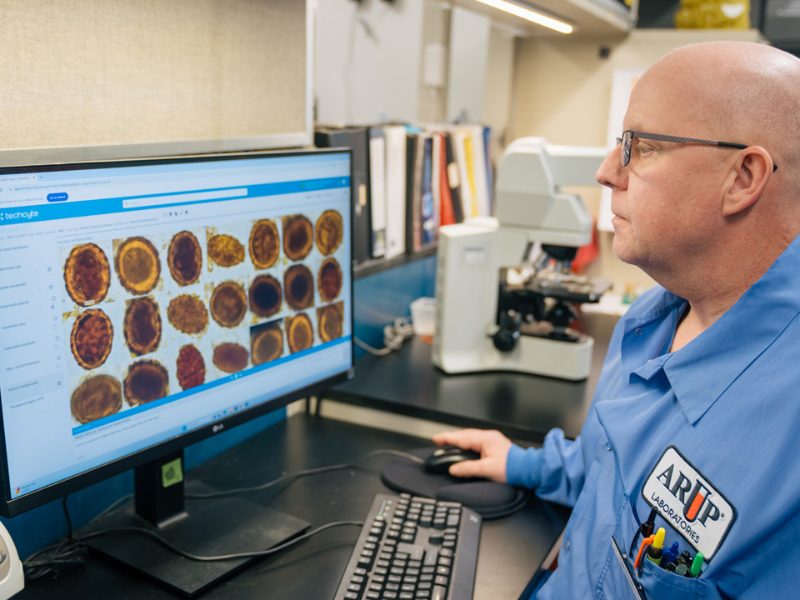 Journal of clinical microbiology publishes article on arup’s validation of ai for parasite detection