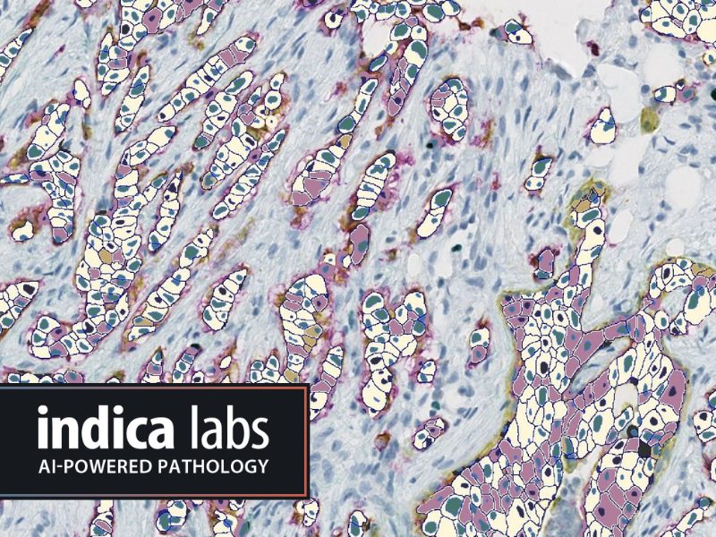 Unlocking the potential of antibody drug conjugates (adc) with halo® image analysis and indica labs pharma services