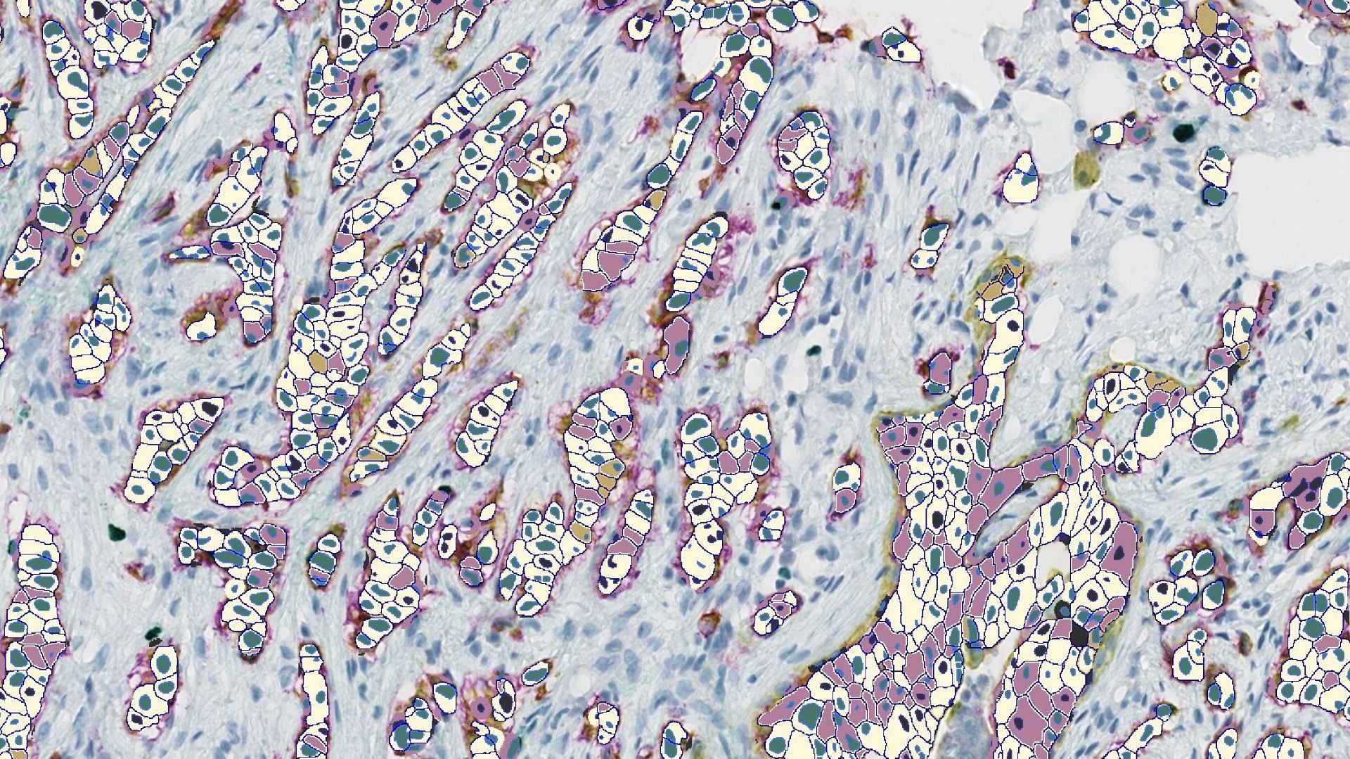 Mihc resized