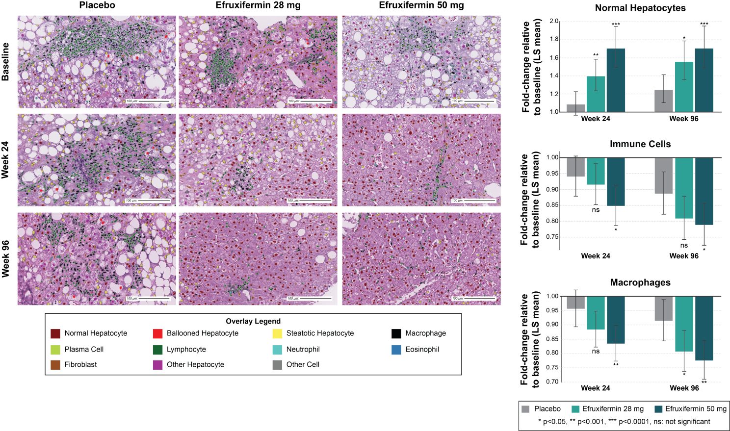 Figure 4. Increase in LiverExplore-quantified normal hepatocytes and reduction in immune cells with efruxifermin.(left) LiverExplore cell overlays from representative biopsies across study arms and timepoints. (right) Fold change from baseline of LiverExplore-quantified cell proportion features (relative to total cell count) across study arms at weeks 24 and 96.