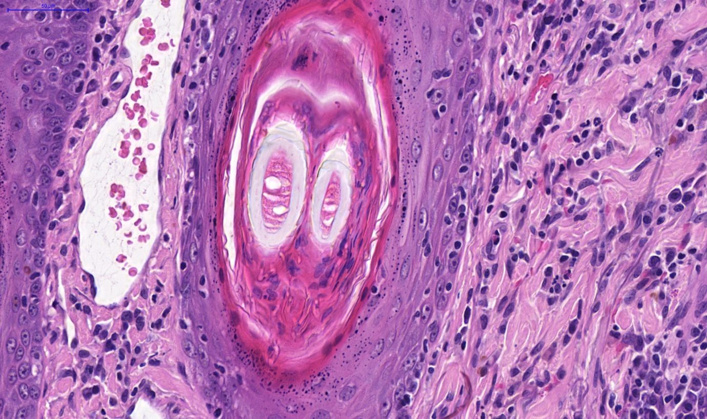 Fig. 3. skin, dog. numerous arthrospores and hyphae within the keratin layers of a hair follicle