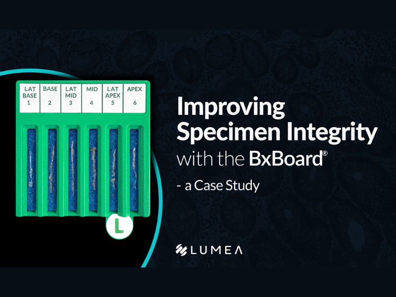Improving specimen integrity with the bxboard® – a case study