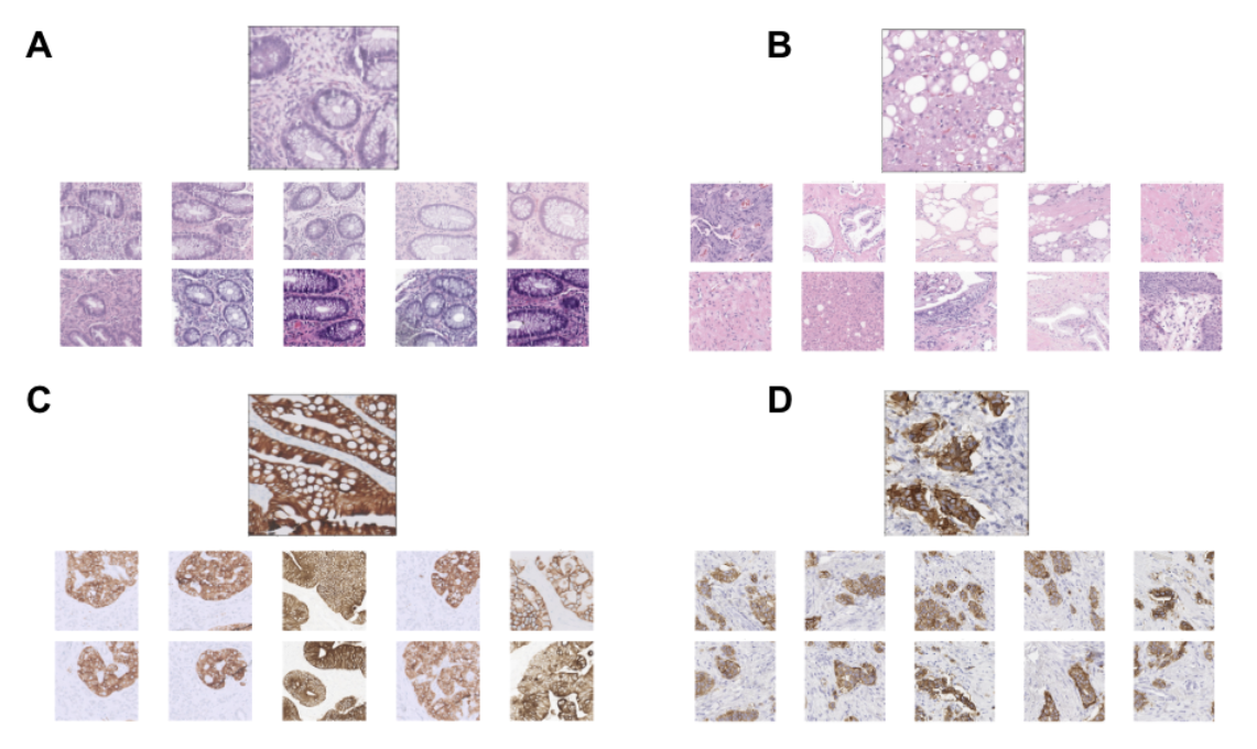 Figure 5: Example query tiles and their top 10 most similar tiles. Queried substances include (A) benign intestinal crypts, (B) steatotic liver tissue, (C) IHC+ gland-forming cancer, and (D) IHC+ tumor cell nests.