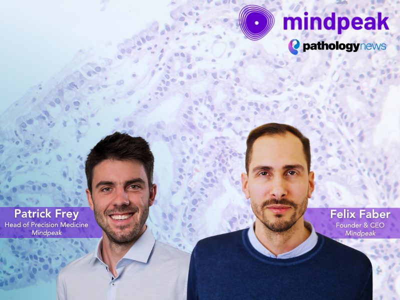Mindpeak esmo tl (800 x 600 px)
