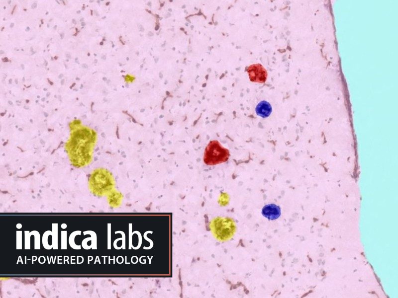 Advancing Neuroscience Research with HALO® and HALO AI