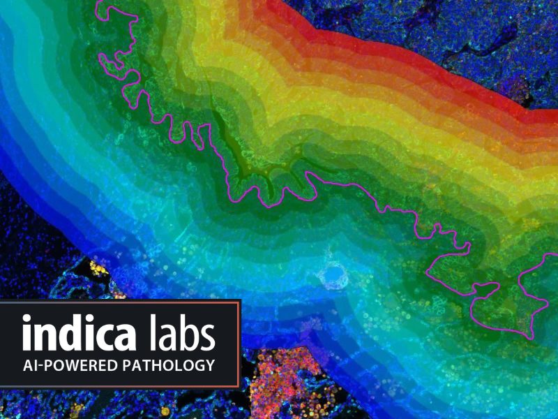 Application Note – Characterizing Immune and Cancer Cell Proximity and Distribution in the Tumor Microenvironment Using HALO® Spatial Analysis Tools