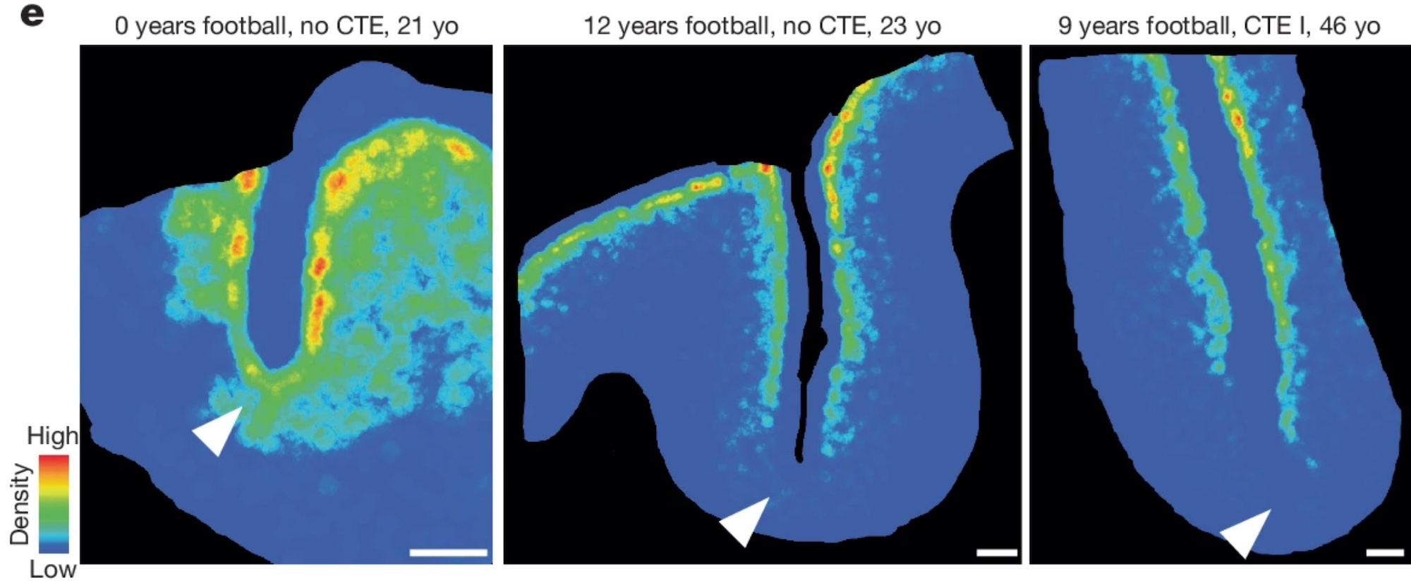 Density heatmap