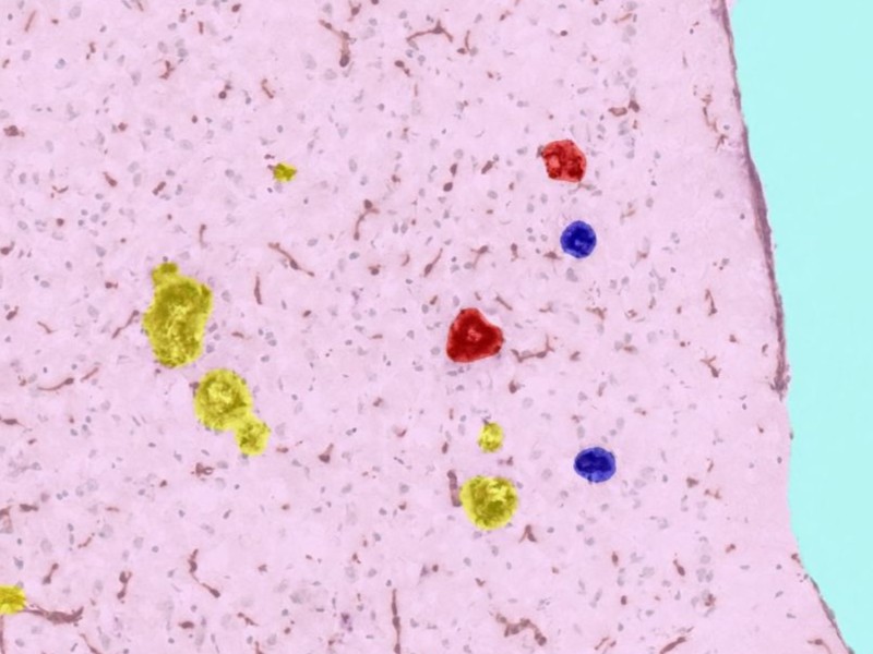 Neuro blog post 800x600