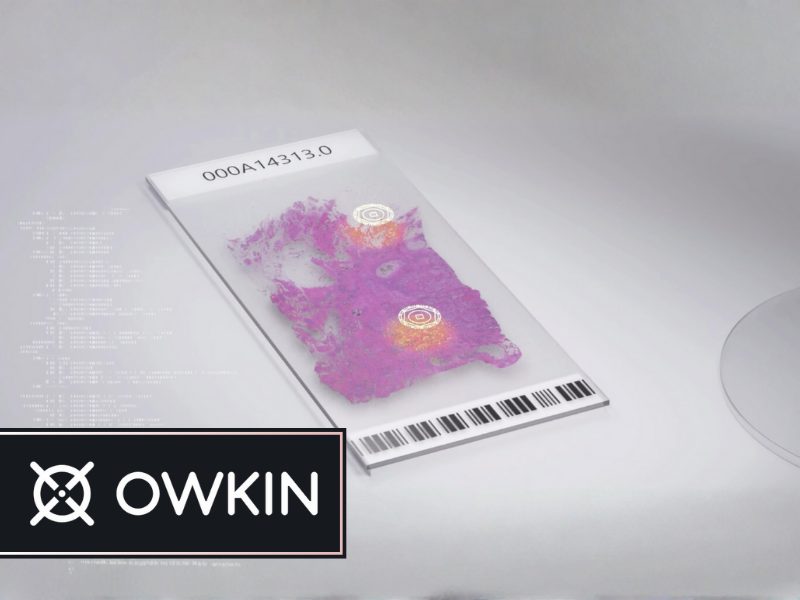Owkin Announces International Validation Results of BRCAura AI Driven Screening for gBRCA Mutations Directly From Pathology Slides