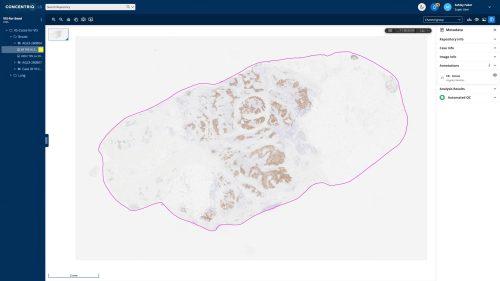 Concentriq LS Image
