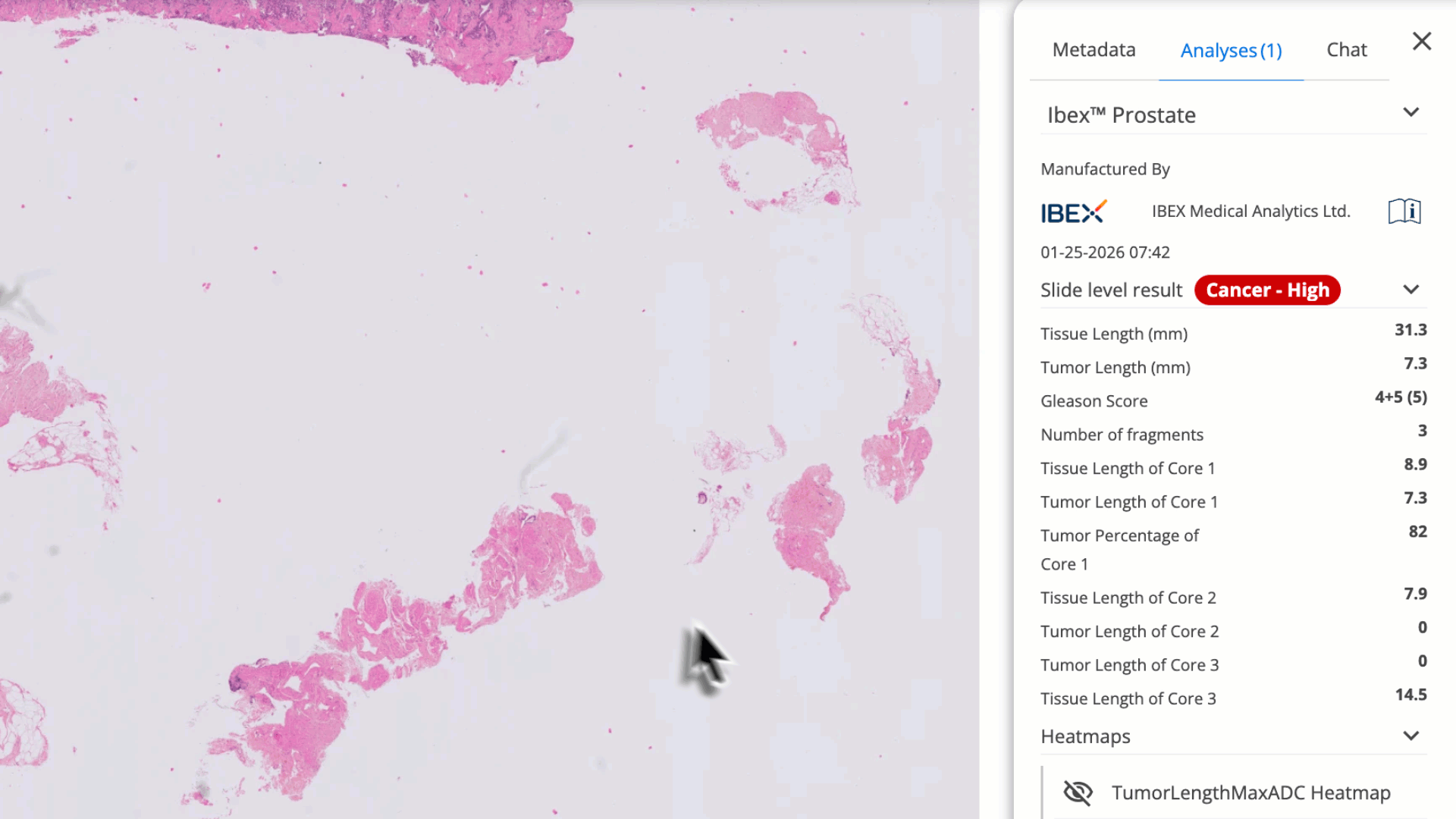 APIbexanalysis 4.11