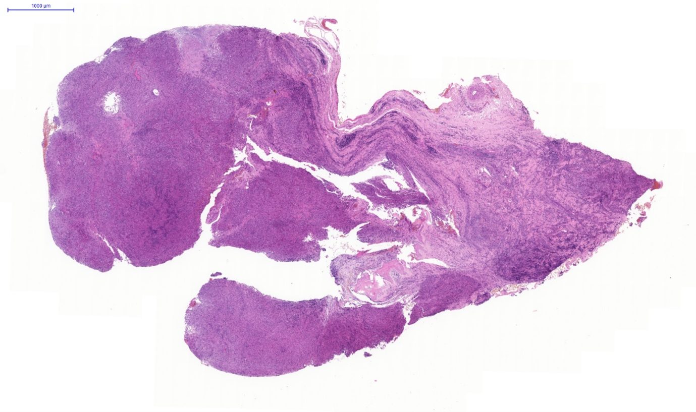 Fig. 1. Nasal tissue, feline. Section of the submitted sample showing severe pyogranulomatous inflammation